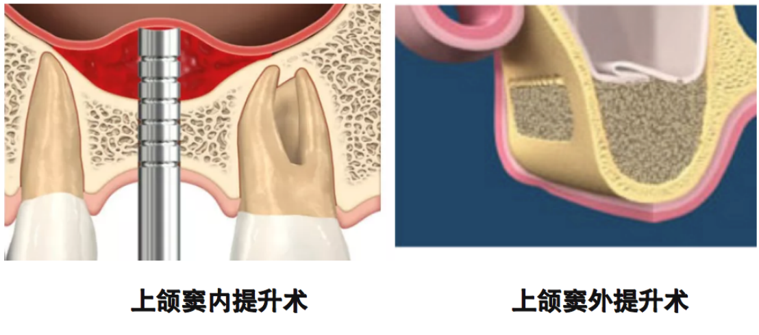 1693029086661.png