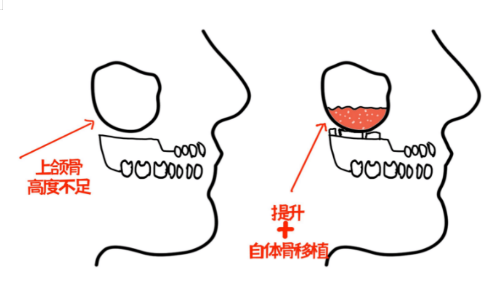 1701428272810.png